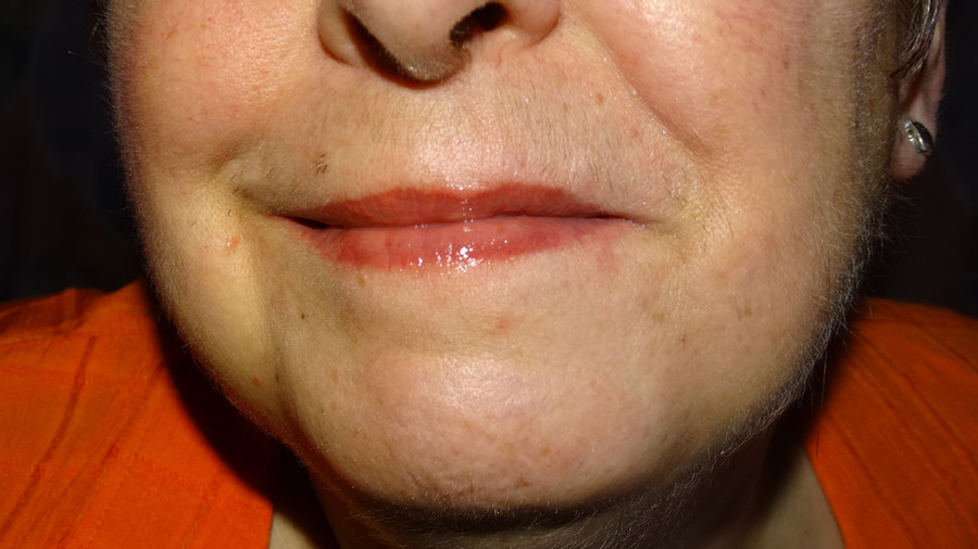 Rote L****n soll man küssen