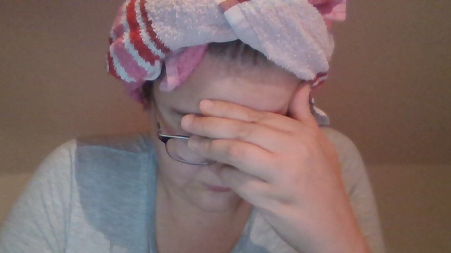 Scars are also beautiful