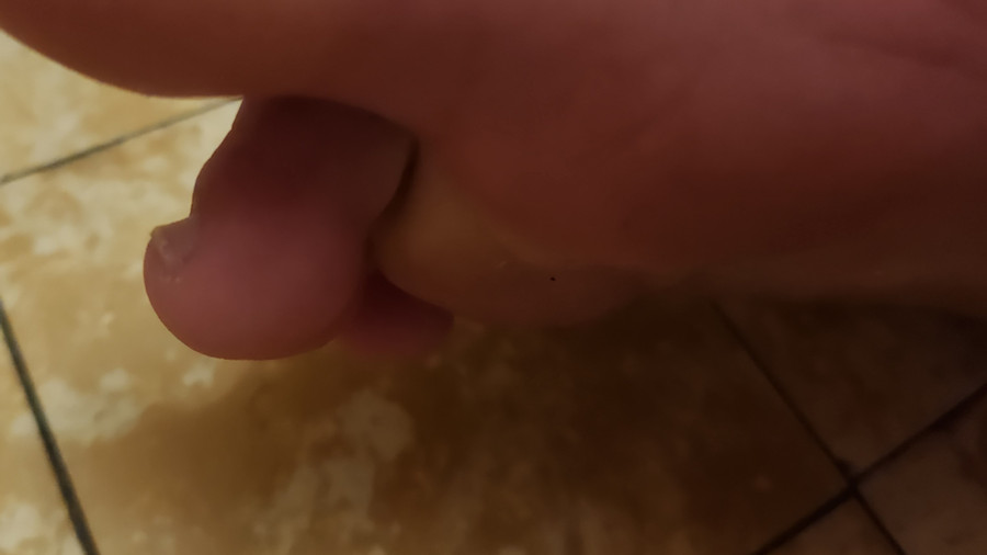 D***kige Zehen und Füße