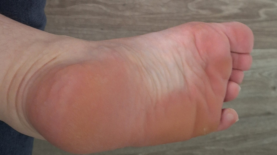 Bilder von meinem Füßen