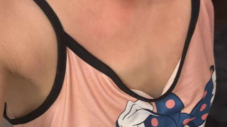 Das Vorschaubild sollte sanft sein, freut euch auf den Inhalt