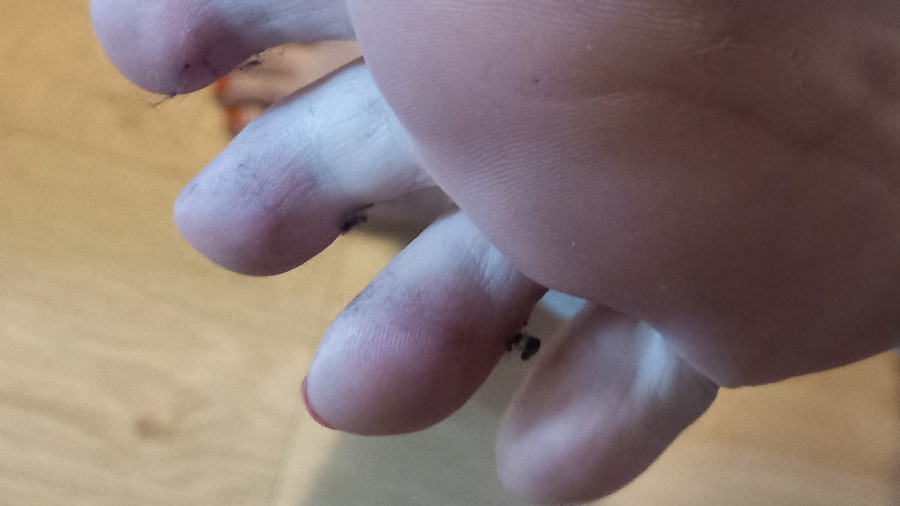 wer mag Fusseln zwischen den Zehen?