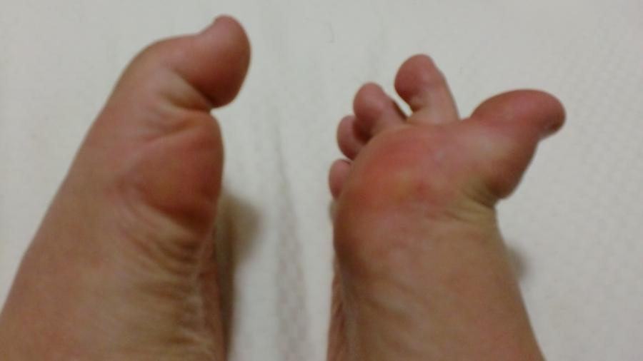 Meine Füße, Zehen und Fußsohlen