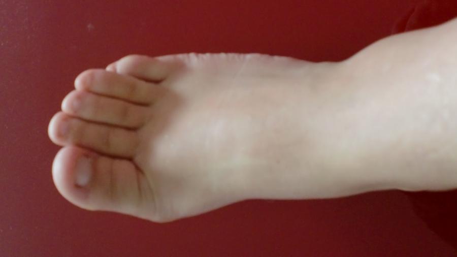 Heiße Füße und g***e Zehen