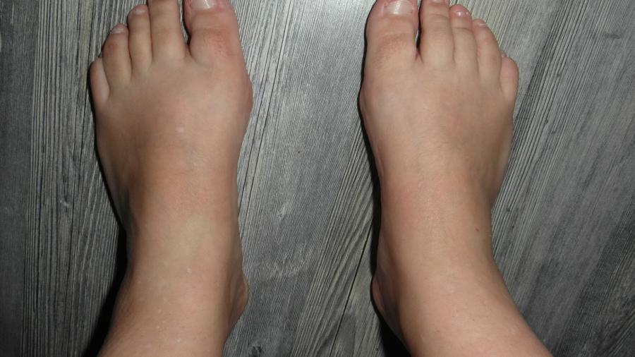 Meine kleinen, zarten Füße nach einem langen Tag