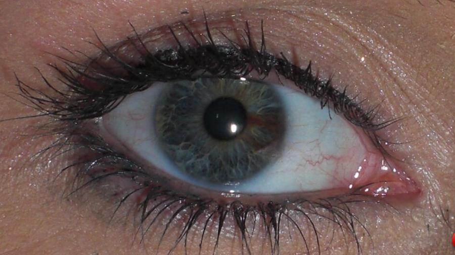 Schau Mir in die Augen